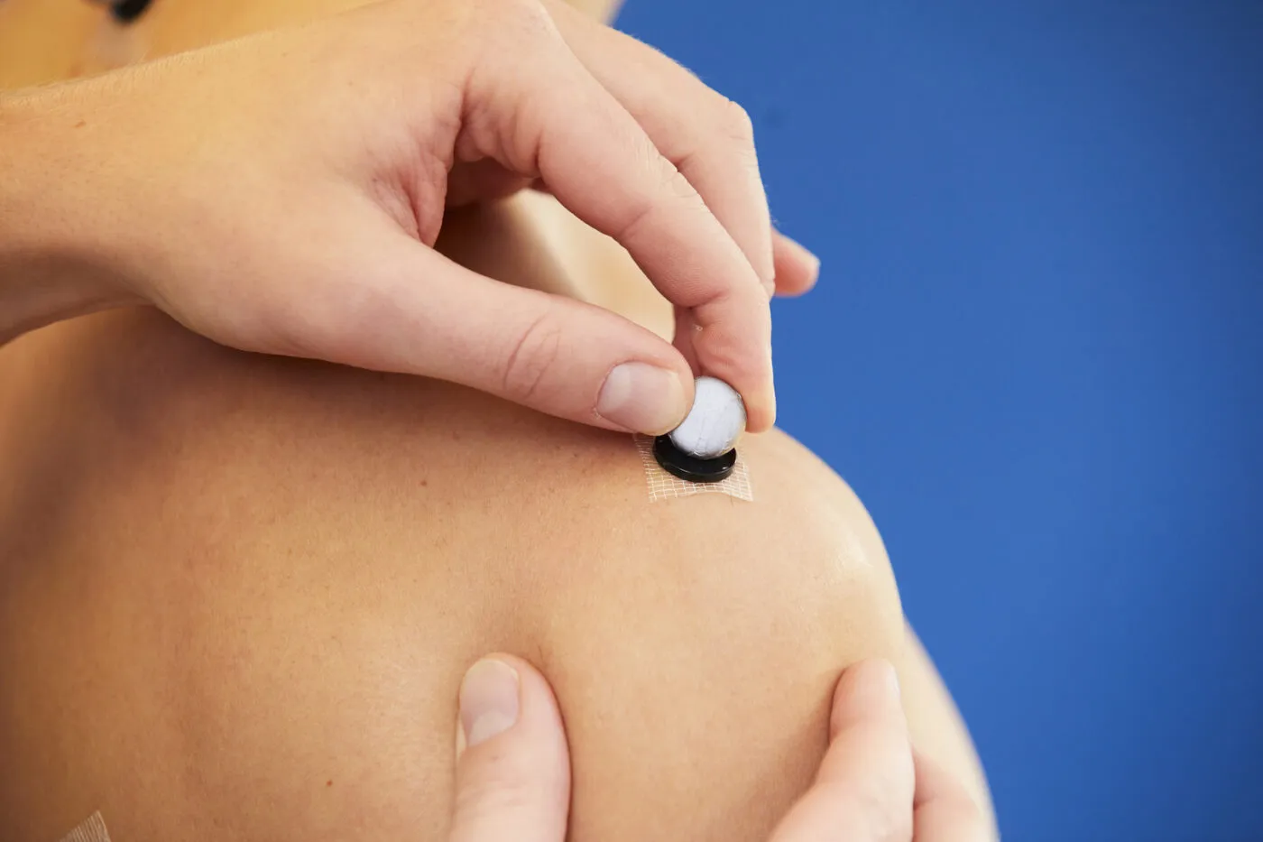 260306 PA2 Adipositas Schulter