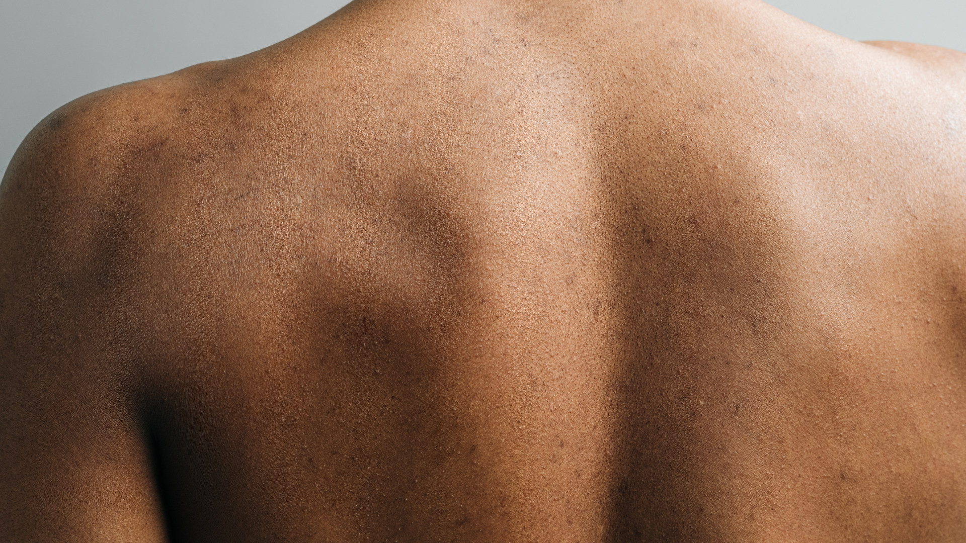 Bild Physioswiss Kampagne Ruecken 1920×1080