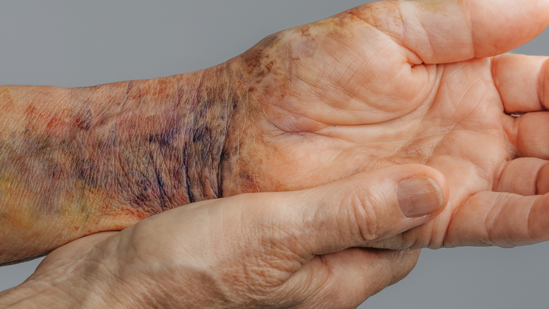 Bild Physioswiss Kampagne Sturz 1920×1080